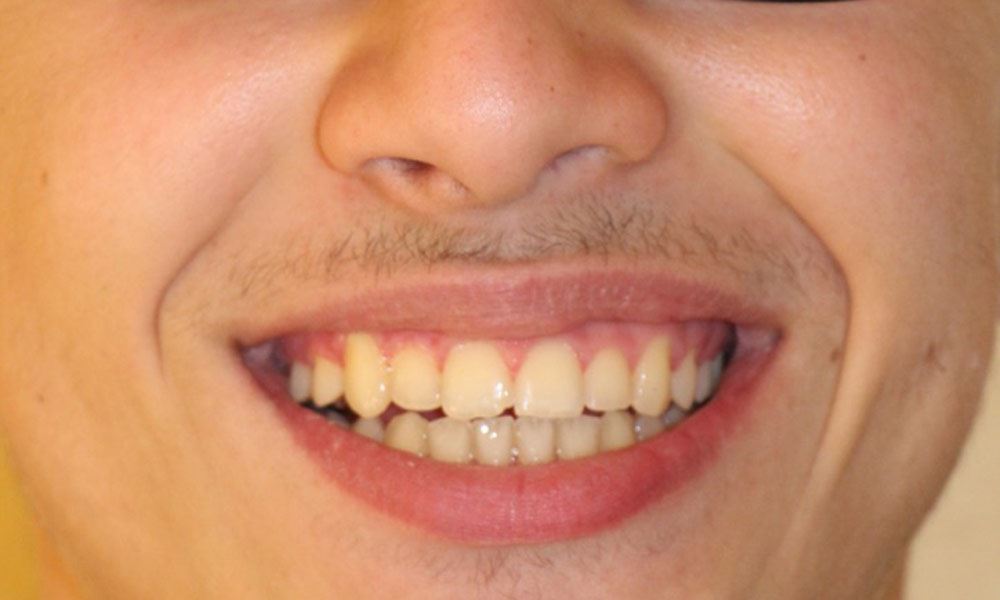 After